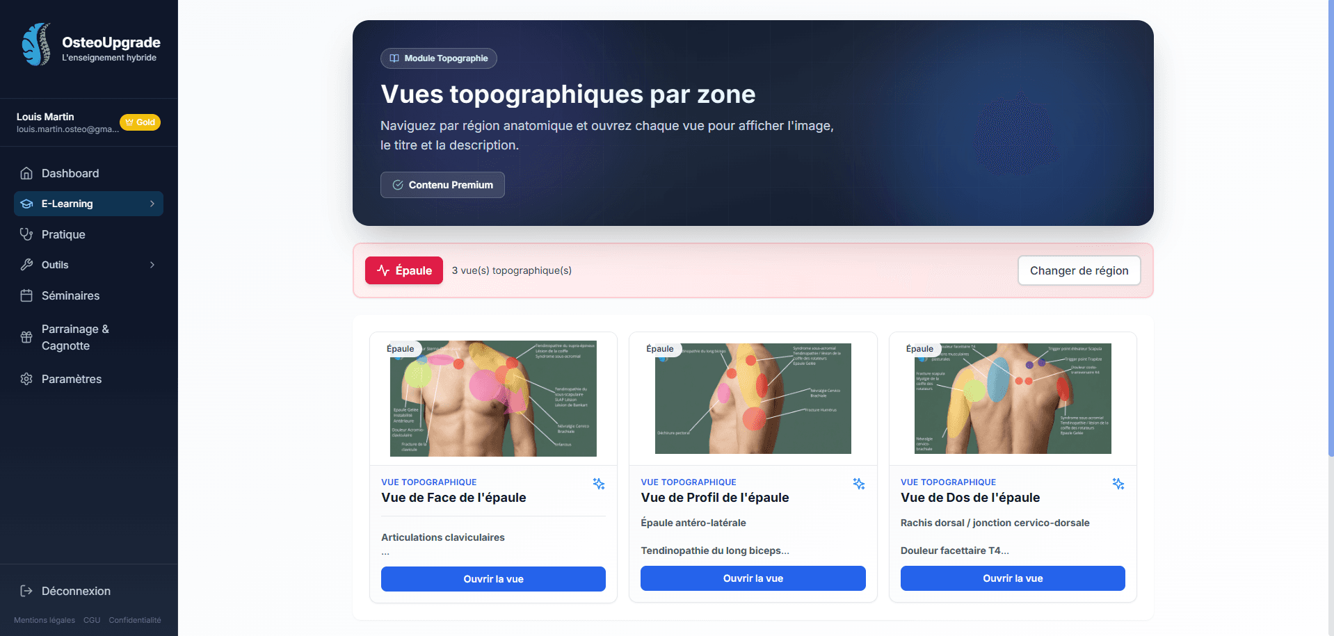 Apercu - Topographie clinique